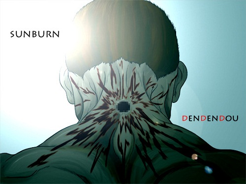 SUNBURN